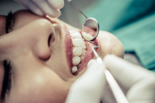 Odontologia Minimamente Invasiva