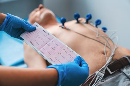 Eletrocardiograma (ECG) Básico